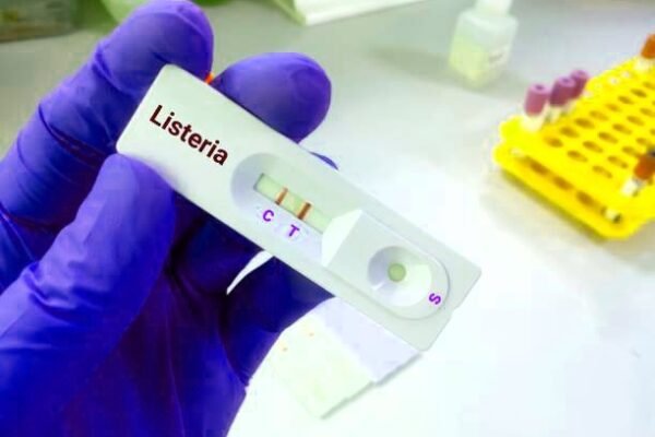 Listeria ,Listeria virus